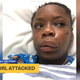 Image for article titled ‘My Black Is Beautiful’: 11-Year-Old Black Girl Beaten in What Family Said Was a Racially Motivated Attack